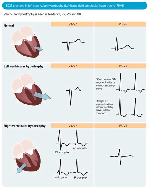 left ventricular voltage function